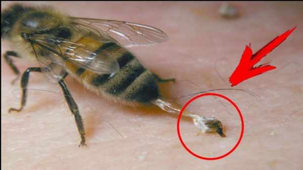 пчела после укуса