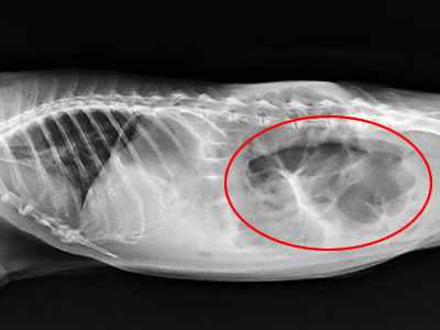 Спайки в кишечнике - рентген
