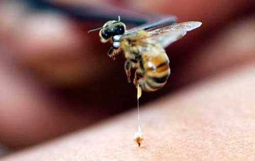 Ужалила пчела