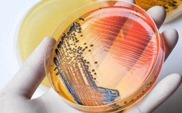 Бактерии сальмонеллы приспосабливаются к воздействию антибиотиков